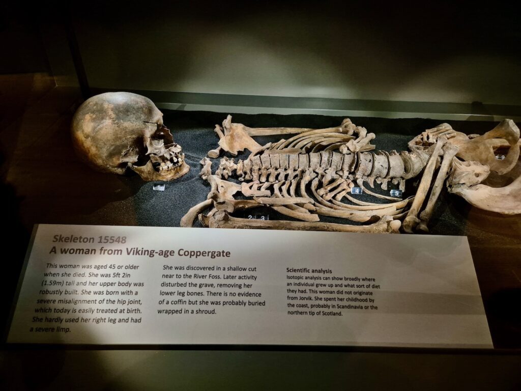 Viking bones on display at the Jorvik Viking Centre